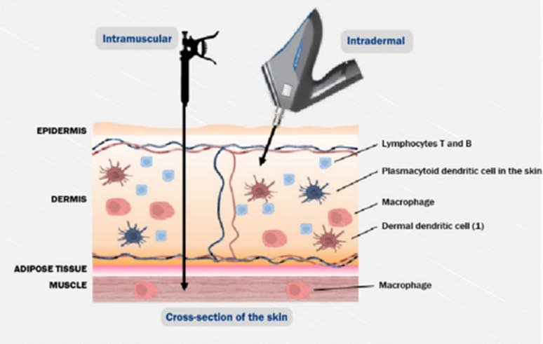 Intradermaal versus intramusculair